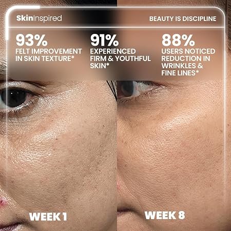 SkinInspired Retinol Night Cream For Wrinkles & Anti-Aging